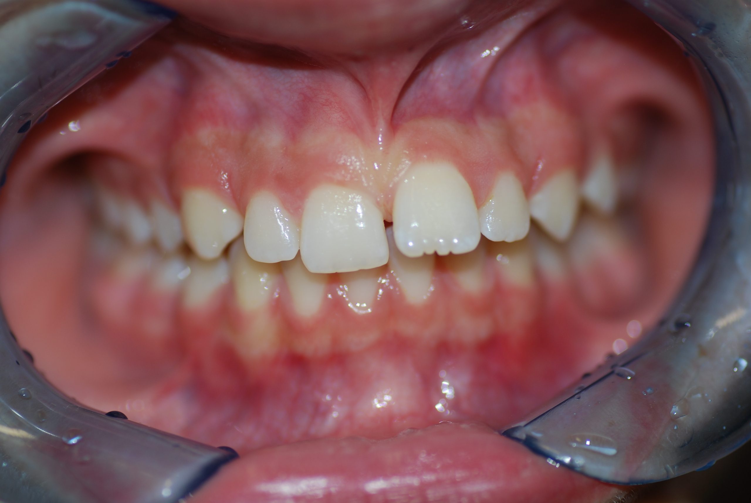 Before image