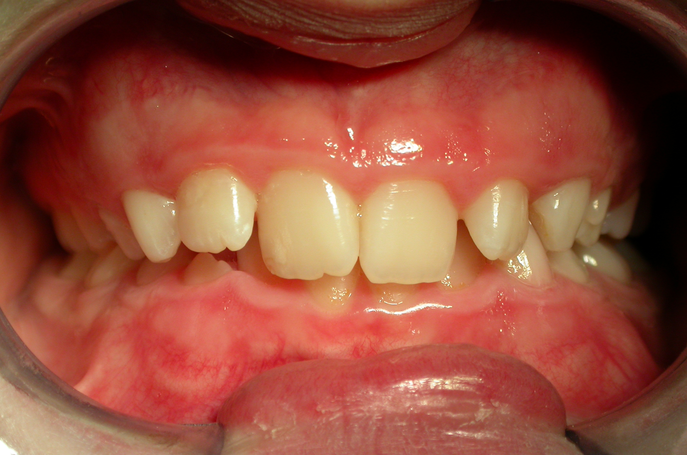 Before image