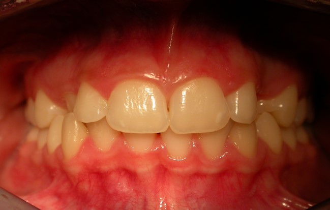 Before image