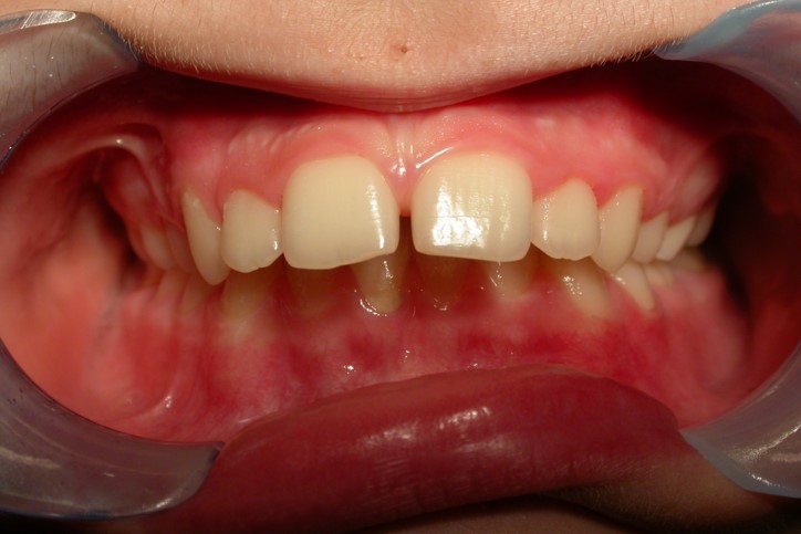 Before image