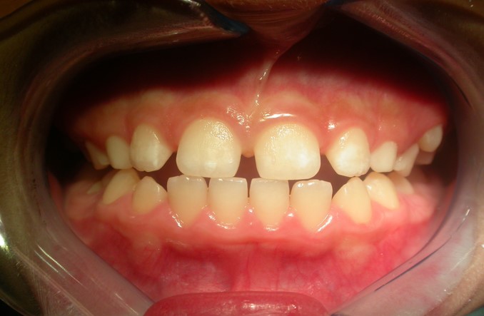 Before image