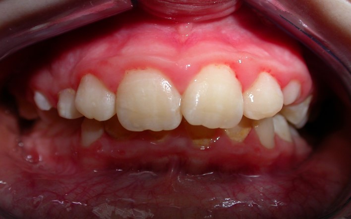 Before image