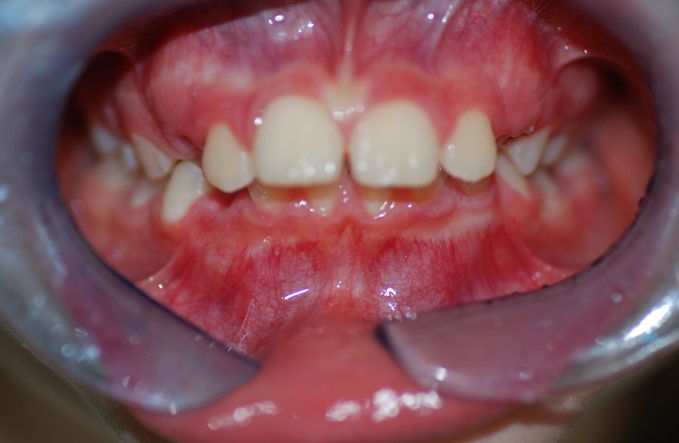 Before image