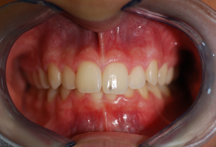 Before image