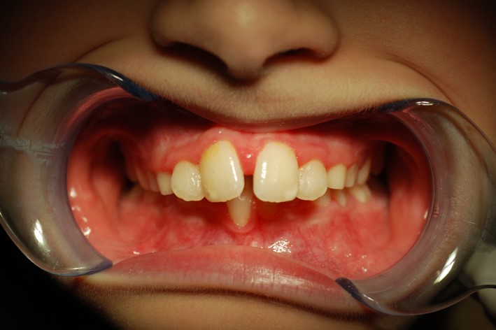 Before image