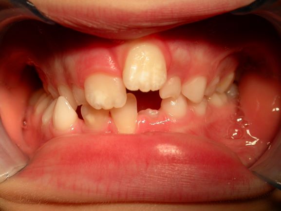 Before image