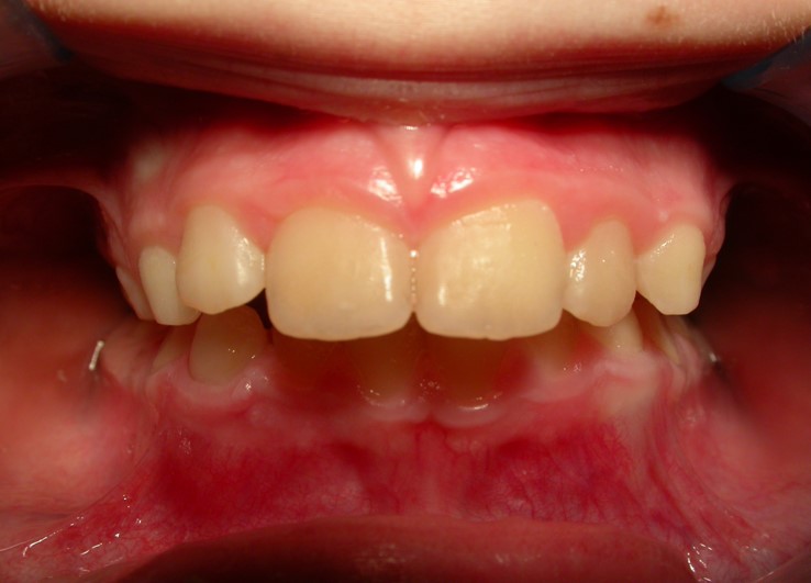 Before image