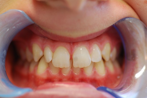 Before image