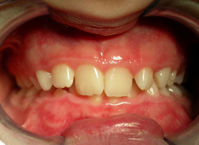 Before image